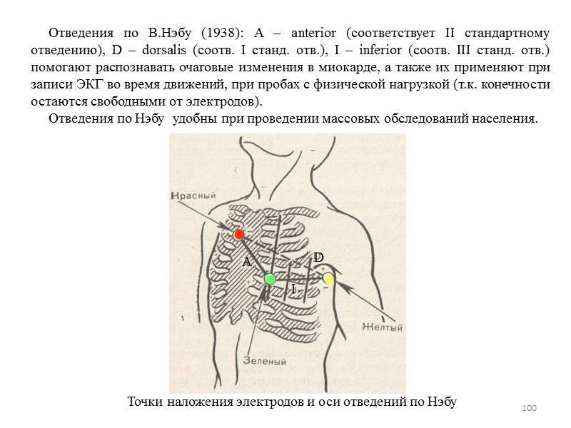 100      Отведения по В.Нэбу (1938): A – anterior (соответствует